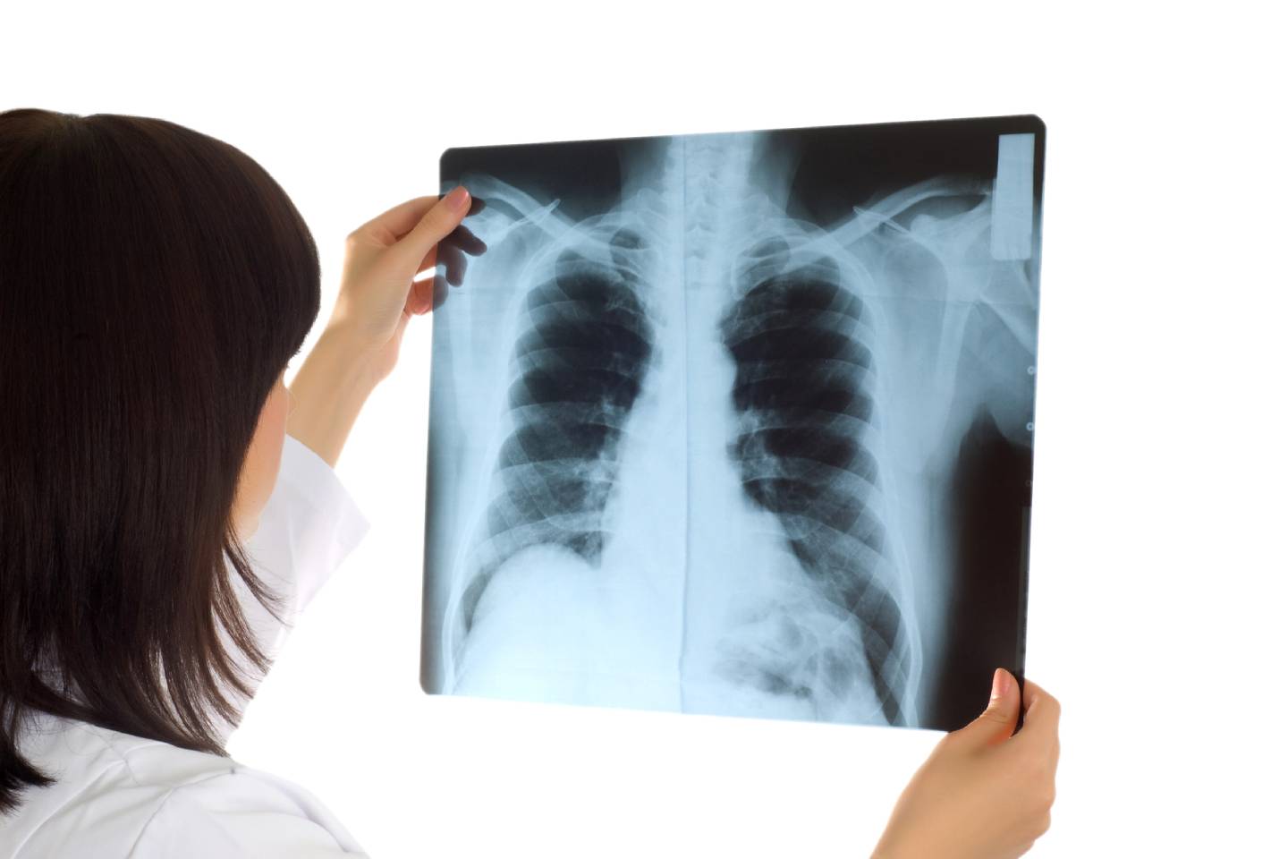 Новости мира / Интересные новости / Искусственный интеллект обучили называть возраст человека по рентгену груди