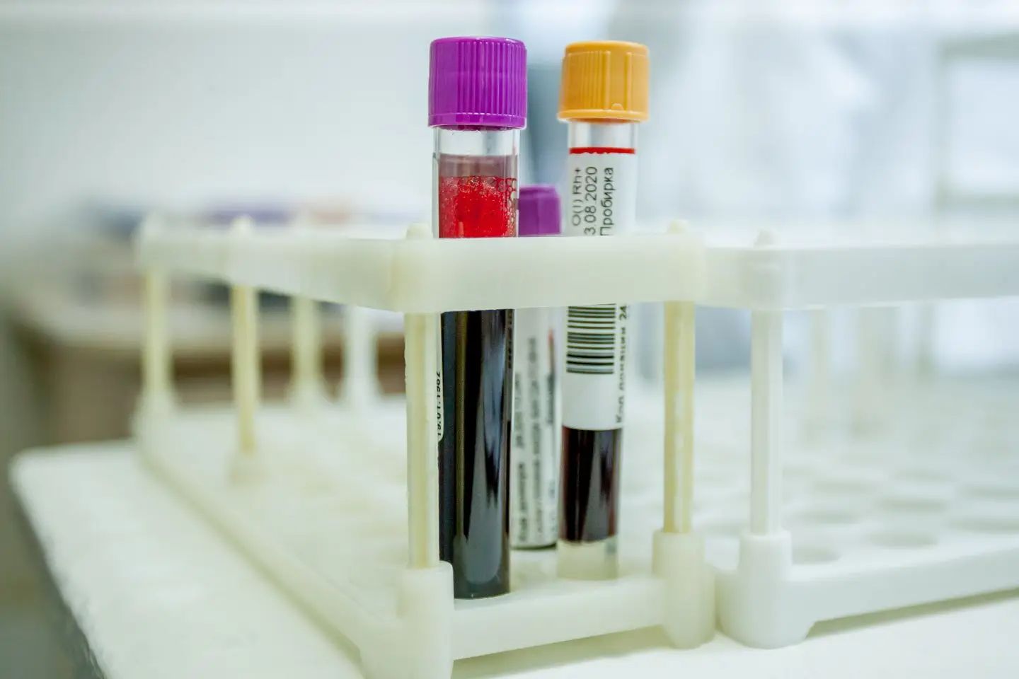 Усть-Каменогорск и ВКО / Усть-Каменогорск / Рождественское чудо: добрую акцию для доноров организует ВКО Центр крови Усть-Каменогорск и ВКО / Усть-Каменогорск / Рождественское чудо: добрую акцию для доноров организует ВКО Центр крови